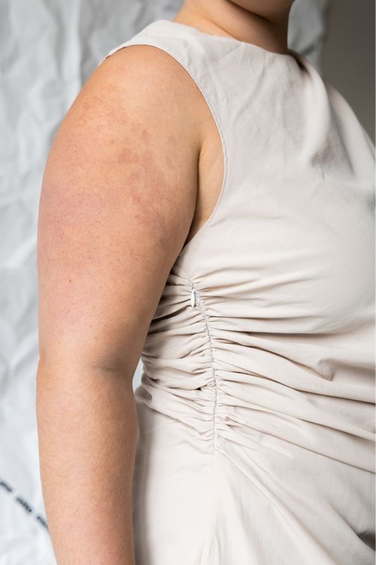 Ruched Dress - Puff and Pencil